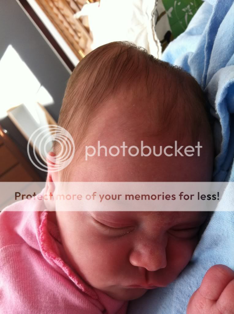 Mega cone head w/pics BabyandBump